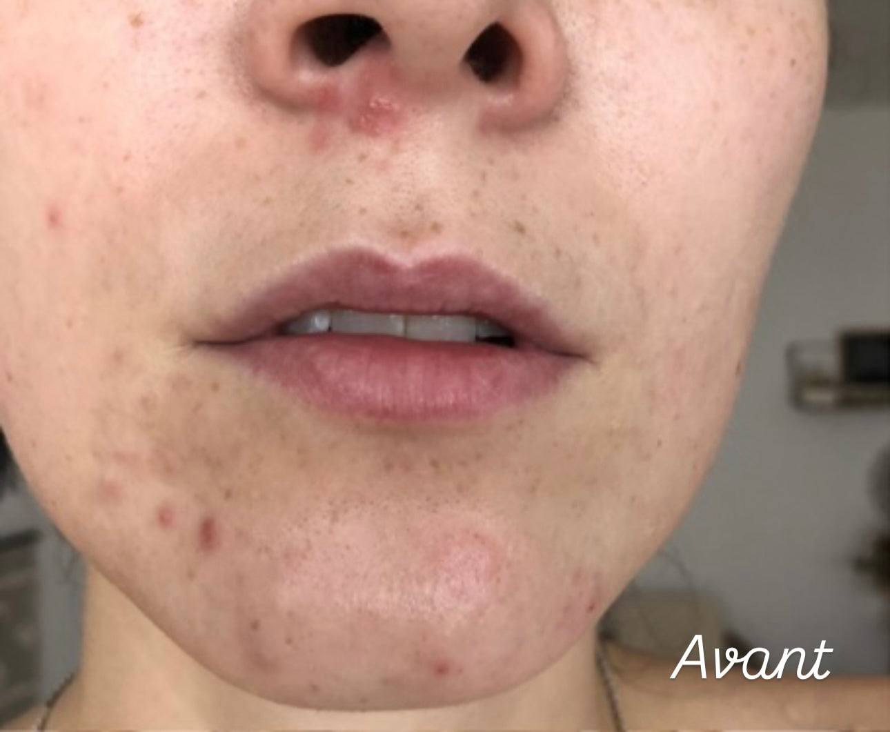 SkinAura™-Brosse nettoyante visage en silicone