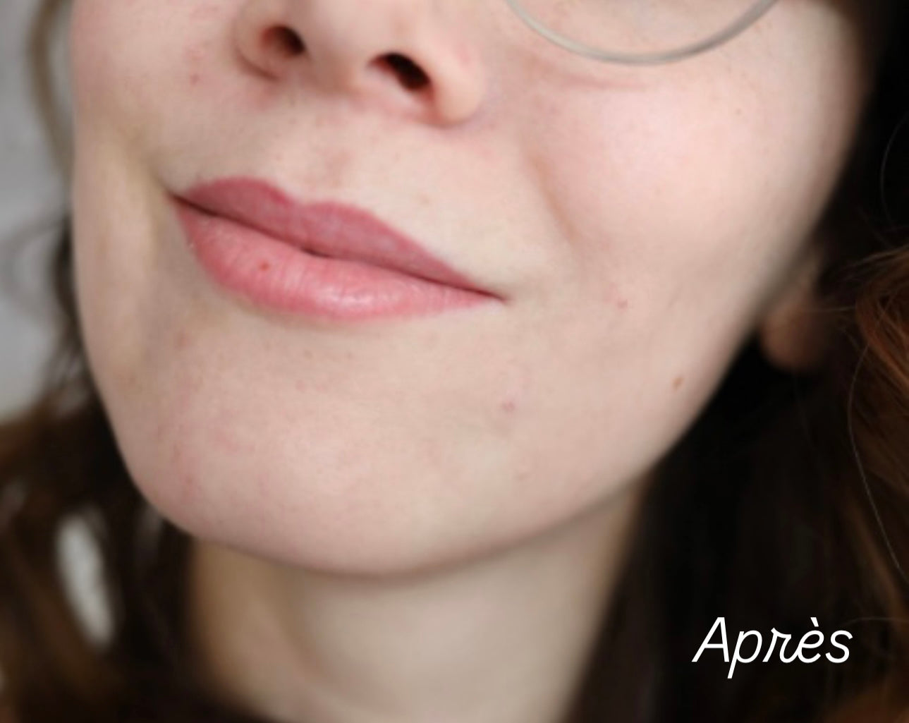 SkinAura™-Brosse nettoyante visage en silicone